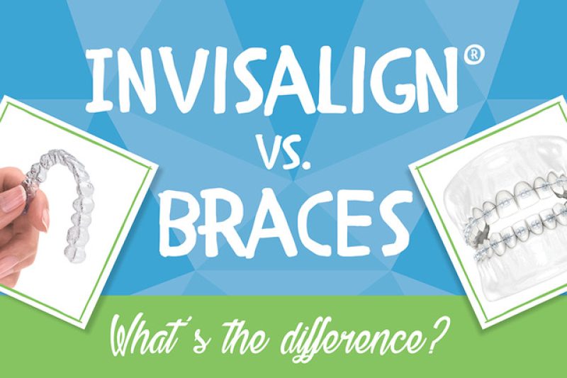 Invisalign vs. Braces What’s the Difference? Gibson Orthodontics